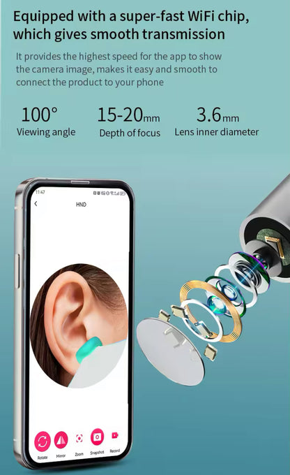 Visueller Ohrenreiniger mit Kamera & WLAN – 1296P, USB-C, LED
